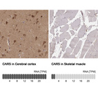 Anti-CARS Antibody