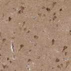 Immunohistochemical staining of human cerebral cortex shows moderate to strong cytoplasmic positivity in neurons.