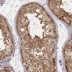 Immunohistochemical staining of human testis shows moderate to strong cytoplasmic positivity in cells in seminiferous ducts.