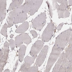Immunohistochemical staining of human skeletal muscle shows no positivity in myocytes as expected.