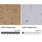 Anti-CARS Antibody