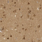 Immunohistochemical staining of human cerebral cortex shows moderate to strong cytoplasmic positivity in neurons.