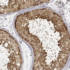 Immunohistochemical staining of human testis shows moderate to strong cytoplasmic positivity in cells in seminiferous ducts.