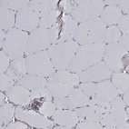 Immunohistochemical staining of human skeletal muscle shows no positivity in myocytes as expected.