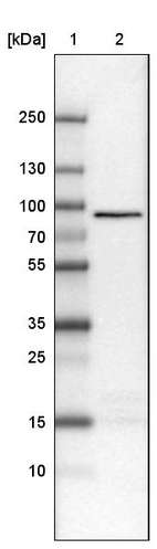 Lane 1: Marker [kDa]_br/_Lane 2: Human cell line U-251 MG