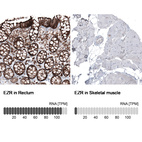 Anti-EZR Antibody