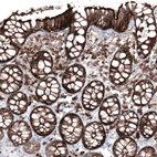 Immunohistochemical staining of human rectum shows strong membranous positivity in glandular cells.