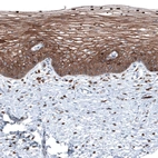 Immunohistochemical staining of human uterine cervix shows strong membranous positivity in squamous epithelial cells.
