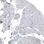 Immunohistochemical staining of human skeletal muscle shows no positivity in myocytes as expected.