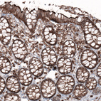 Anti-EZR Antibody