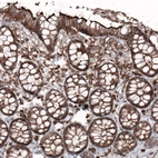 Immunohistochemical staining of human rectum shows strong membranous positivity in glandular cells.