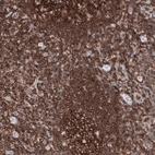 Immunohistochemical staining of human tonsil shows strong membranous positivity in non-germinal center cells.