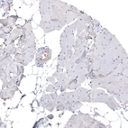 Immunohistochemical staining of human skeletal muscle shows no positivity in myocytes as expected.