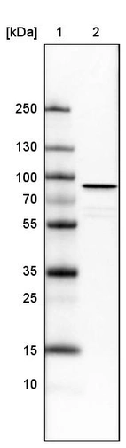Lane 1: Marker [kDa]_br/_Lane 2: Human cell line U-251 MG