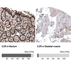 Anti-EZR Antibody