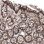 Immunohistochemical staining of human rectum shows strong membranous positivity in glandular cells.