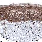 Immunohistochemical staining of human uterine cervix shows strong membranous positivity in squamous epithelial cells.
