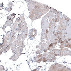Immunohistochemical staining of human skeletal muscle shows negative to very weak positivity in myocytes.