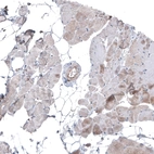 Immunohistochemical staining of human skeletal muscle shows negative to very weak positivity in myocytes.