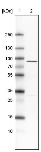 Anti-EZR Antibody