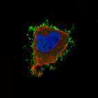 Anti-EZR Antibody