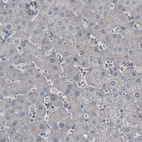 Immunohistochemical staining of human liver shows absence of immunoreactivity (negative control).