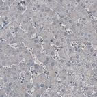 Immunohistochemical staining of human liver shows absence of immunoreactivity (negative control).