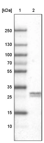 Lane 1: Marker [kDa]_br/_Lane 2: Human testis tissue lysate