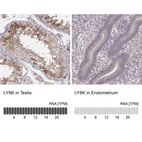 Anti-LY6K Antibody