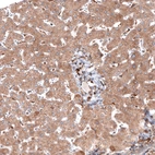 Immunohistochemical staining of human liver shows moderate cytoplasmic positivity in hepatocytes.