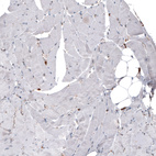 Anti-PDIA3 Antibody