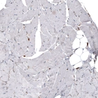 Immunohistochemical staining of human skeletal muscle shows no positivity in myocytes as expected.