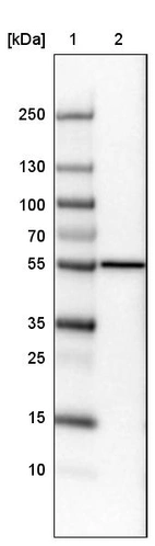 Lane 1: Marker [kDa]_br/_Lane 2:Human cell line U-251 MG