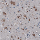 Anti-GORASP2 Antibody