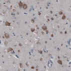 Immunohistochemical staining of human cerebral cortex shows moderate cytoplasmic positivity in neurons.