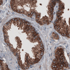 Anti-GORASP2 Antibody