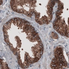 Immunohistochemical staining of human prostate shows strong cytoplasmic positivity in glandular cells.