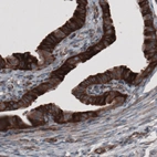Immunohistochemical staining of human fallopian tube shows strong cytoplasmic immunoreactivity in glandular cells.