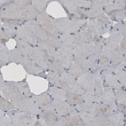 Immunohistochemical staining of human skeletal muscle shows absence of immunoreactivity (negative control).
