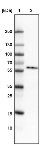 Lane 1: Marker [kDa]_br/_Lane 2: Human cell line U-251 MG