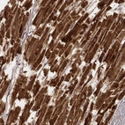 Immunohistochemical staining of human heart muscle shows strong cytoplasmic positivity in cardiomyocytes.