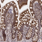 Immunohistochemical staining of human small intestine shows strong cytoplasmic positivity in glandular cells.