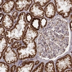 Immunohistochemical staining of human kidney shows strong cytoplasmic positivity in cells in tubules.
