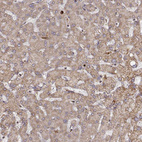 Immunohistochemical staining of human liver shows negative to very weak positivity in hepatocytes.