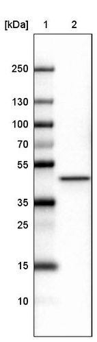 Lane 1: Marker [kDa]_br/_Lane 2: Human cell line U-251 MG