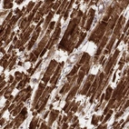 Immunohistochemical staining of human heart muscle shows strong cytoplasmic positivity in cardiomyocytes.