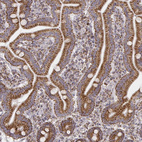 Anti-CS Antibody