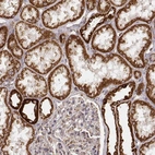 Immunohistochemical staining of human kidney shows strong cytoplasmic positivity in cells in tubules.