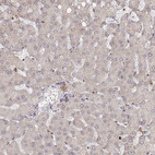 Immunohistochemical staining of human liver shows no positivity in hepatocytes as expected.