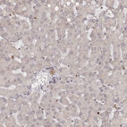 Immunohistochemical staining of human liver shows no positivity in hepatocytes as expected.